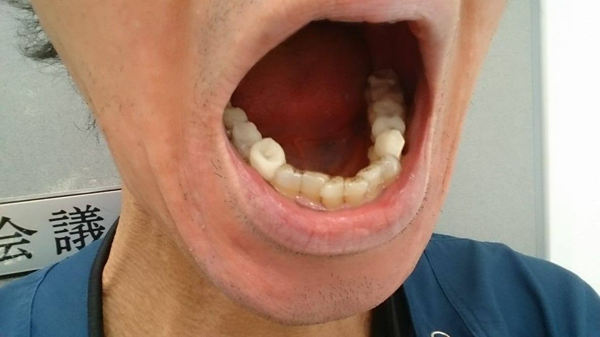 西村式顎関節症治療実践セミナー « 寺浦歯科医院ブログ